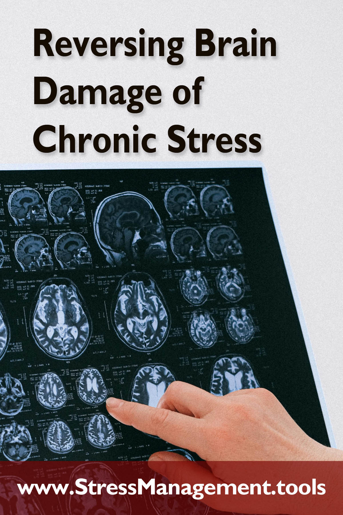 Reversing Brain Damage of Chronic Stress