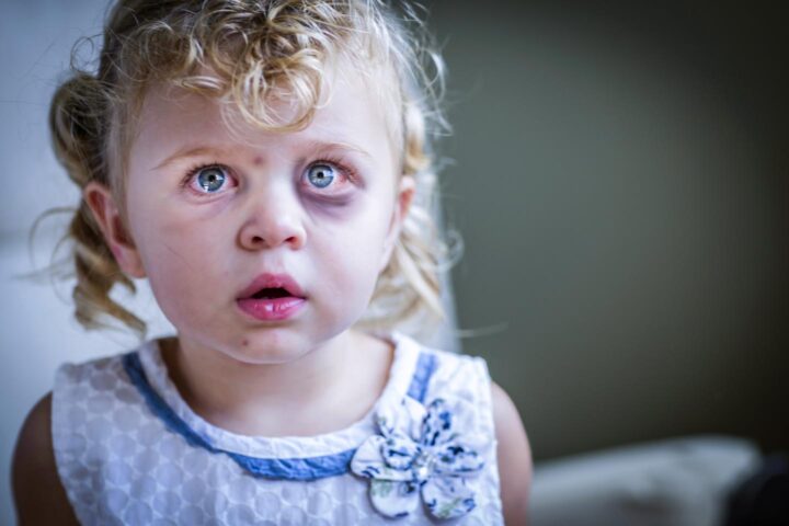 A young girl being victim of physical abuse